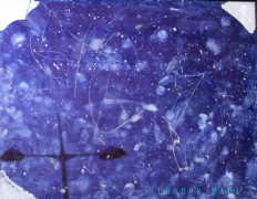 cashpoint blues withdrawal symptoms